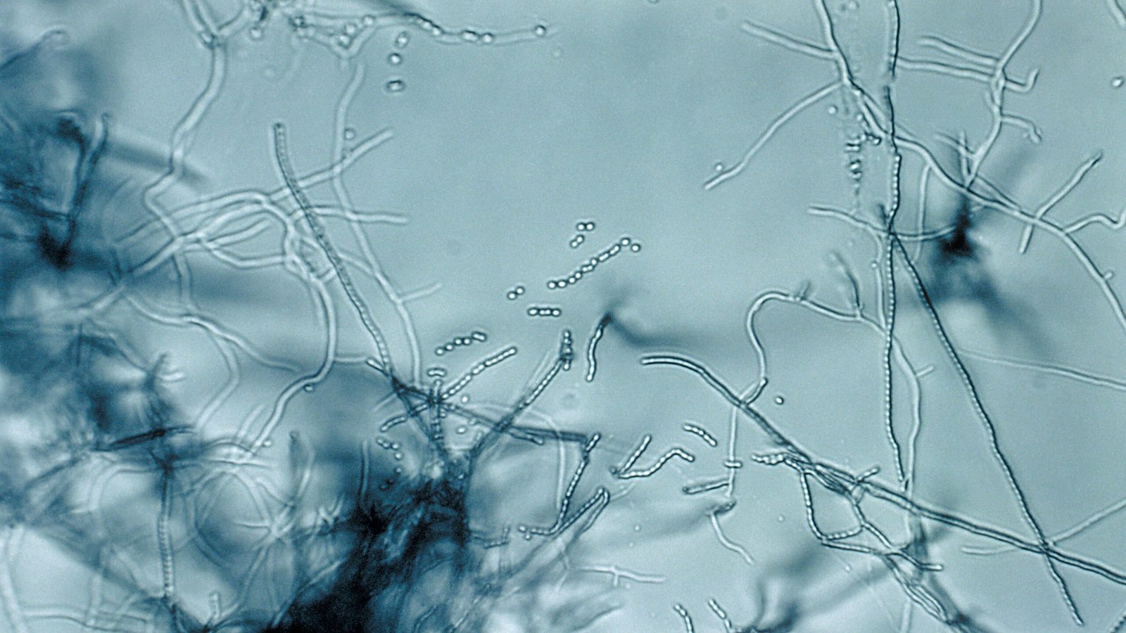 Microscopic view of antibiotic megacluster discovery offering new hope against superbugs.